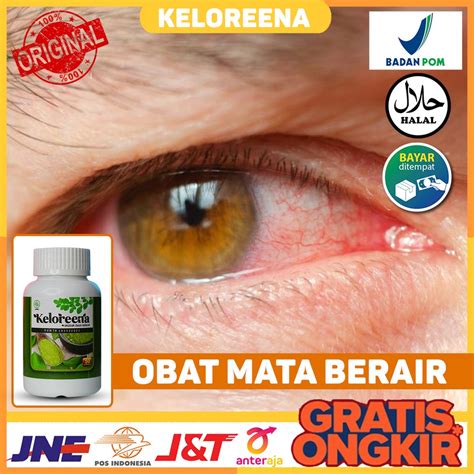 Jual Obat Mata Berair Mata Kering Mata Bengkak Bintitan Mata Buram