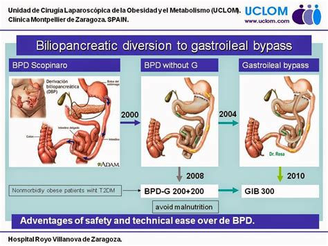 Bypass Gastroileal Del Dr Resa Ifso New Delhi