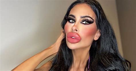 Nurse Spent Thousands Of Dollars On Plastic Surgery Including Five Boob