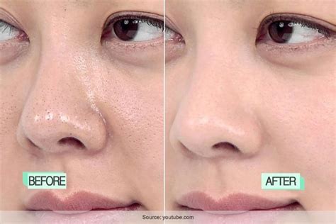 Skin Pores Are Always A Problem Here You Learn How To Tighten Pores Naturally Right Here