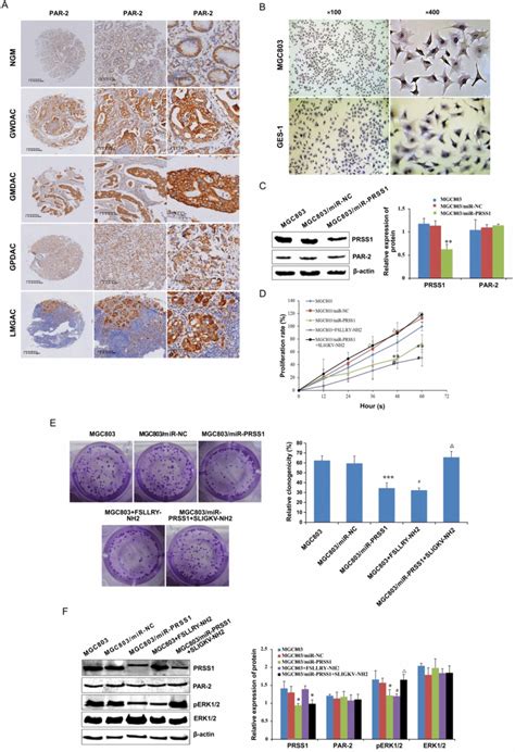 Prss Affects Cell Proliferation Via The Par Activated Erk Signaling