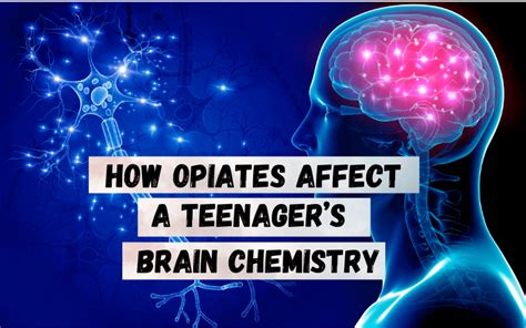 Effects Of Opioids On The Teenage Brain Key Healthcare