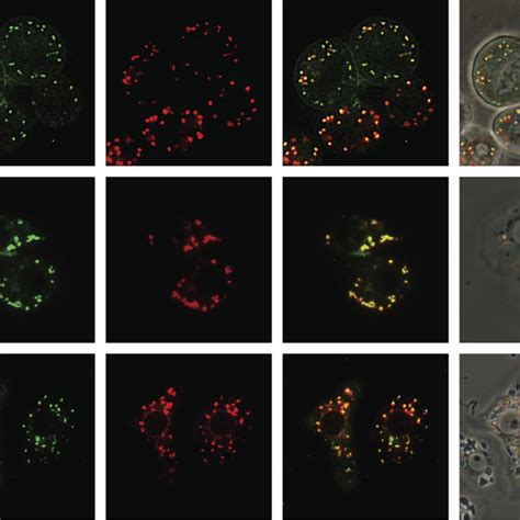 Intracellular Distribution Of Gfp Tagged Sf Fdl And Various Organelles