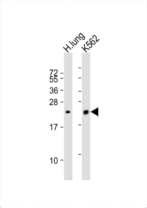 Sftpc Antibody C Term Affinity Purified Rabbit Polyclonal Antibody