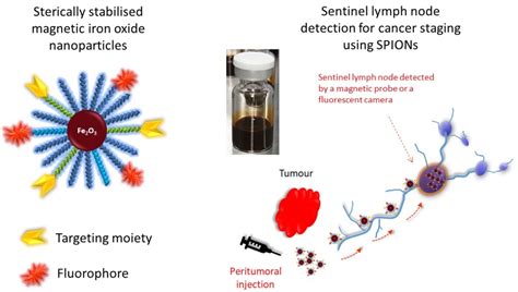 University nanotechnology approved for “First in Human” trials - The University of Sydney