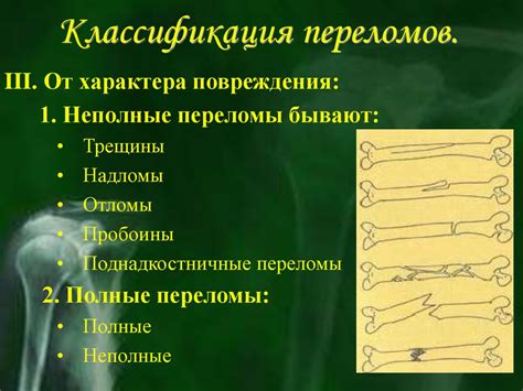 Перелом локтевого сустава со смещением и без: симптомы и лечение