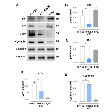 HPV 18 E2 Expression Extends Replicative Lifespan Of HFK And Modulates