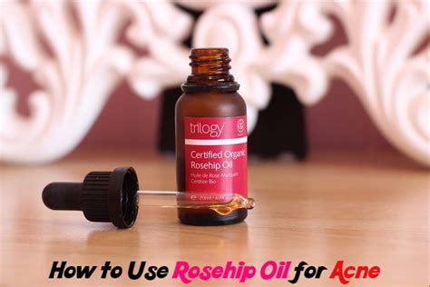 How to Use Rosehip Oil for Acne Skin Treatment - Stylish Walks