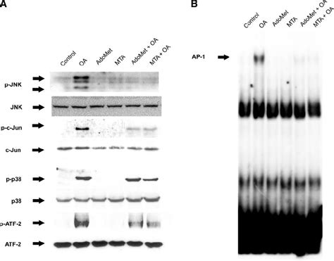 Effect of pretreatment with S adenosylmethionine AdoMet and 5 Ј