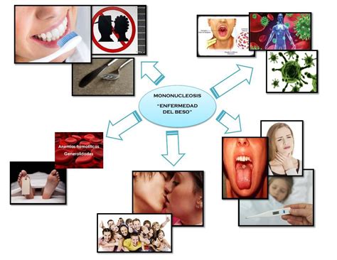 Mapa Mental De La Enfermedad Del Beso Pdf Document Porn Sex Picture
