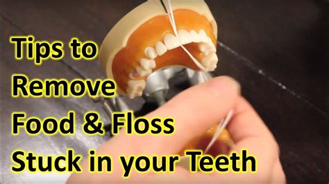 How To Remove Food Stuck In Teeth Floss Stuck Between Teeth My Teeth