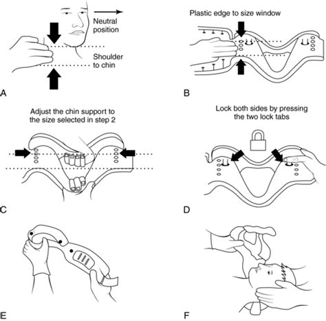 Cervical Collar Application