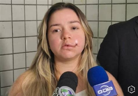 Modelo denuncia síndico por agressão em Teresina PI