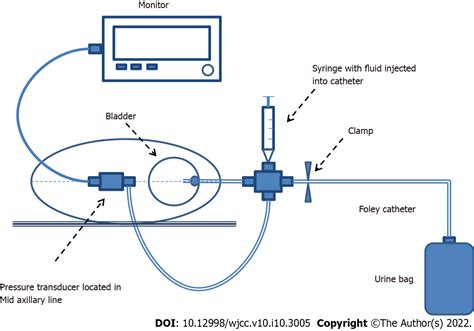 Elevated Intra Abdominal Pressure A Review Of Current Knowledge