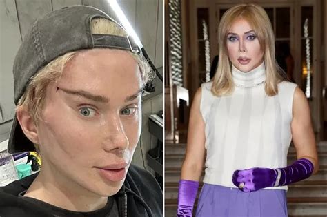 Bloke Has To Have Penis Amputated After Crazy Ecstasy Fuelled Hour Sex Marathon Daily Star