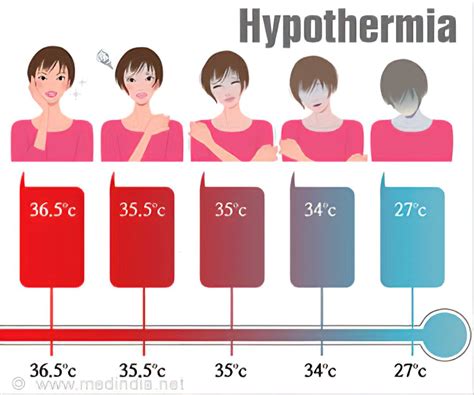 Hypothermia Causes Signs Symptoms Stages Treatment