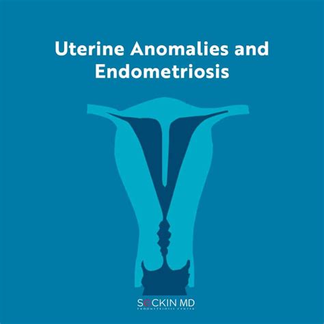 Uterine Anomalies And Endometriosis Seckin Endometriosis Center