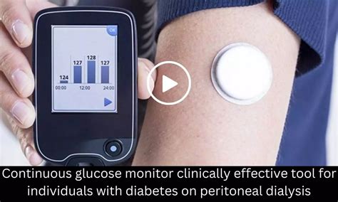 Continuous Glucose Monitor Clinically Effective Tool For Individuals