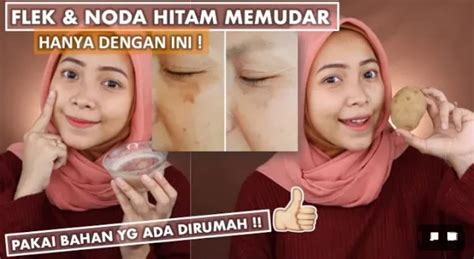 Masker Penghilang Flek Hitam Tebal Dengan Bahan Dapur Wajah Langsung