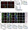 Jci Norepinephrine Metabolite Dopegal Activates Aep And Pathological