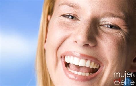 Estética Dental Soluciones Para Lucir Una Sonrisa Perfecta Mujerdeelite