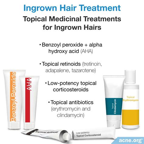 What Are Ingrown Hairs