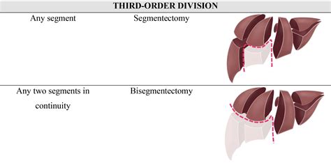 Liver Surgery Important Considerations For Pre And Postoperative