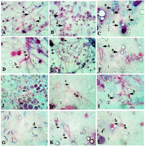 The Photomicrographs Of Sperm Morphology In Control And Other Groups