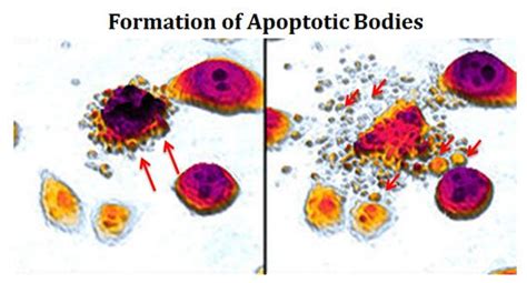 Mechanism Of Apoptosis Its Significance Easybiologyclass