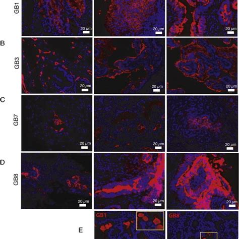 Immunofluorescence Labeling Of Formalin Fixed Paraffin Embedded Ffpe Download Scientific