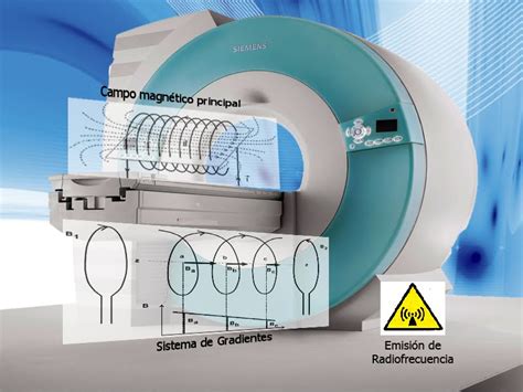 Resonancia Magnética De Cerebro