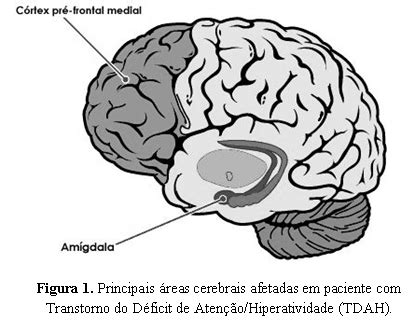 Aspectos Neurobiol Gicos Do Transtorno Do D Ficit De Aten O E