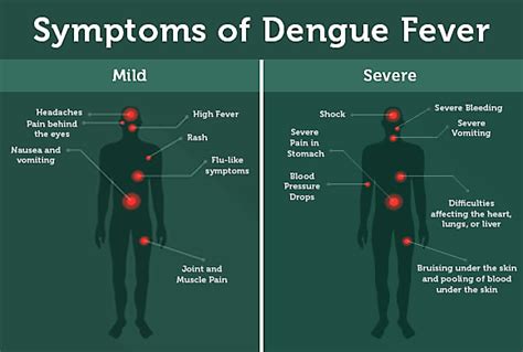 Dengue Fever Rash Face