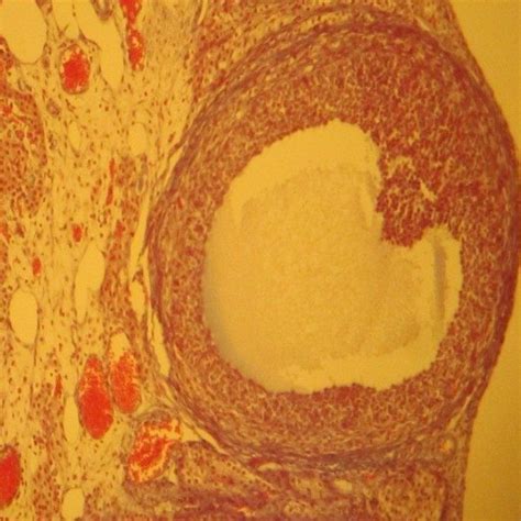 Photomicrograph Of Ovary Tissue Of Control Group Shows Normal Structure