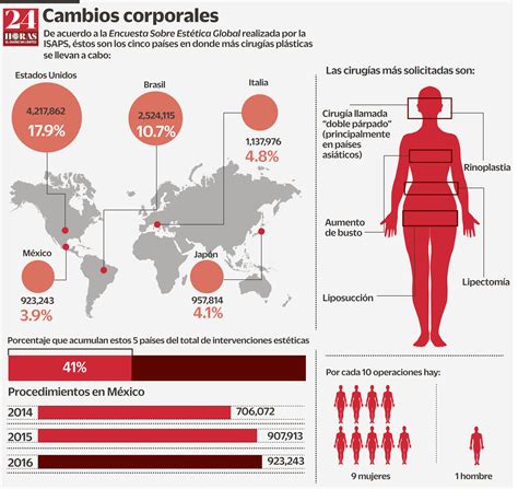M Xico Se Ubica En El Ranking De Pa Ses Con M S Cirug As Est Ticas