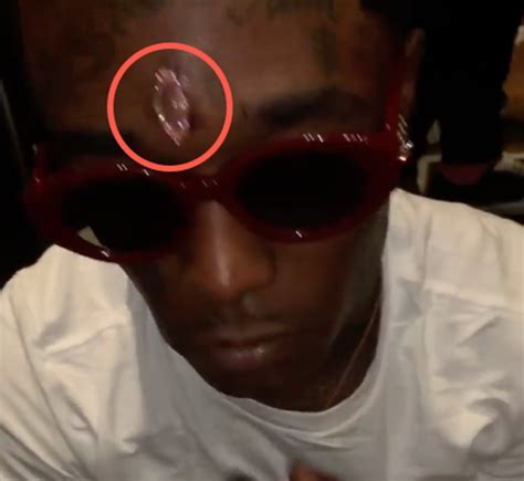 Rapper Lil Uzi Got $24 Million Diamond Pierced In His Forehead | LaptrinhX