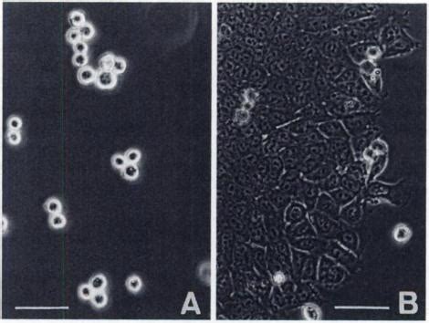 Phase Contrast Micrographs Of Hsc A And A B Cells Note Loose