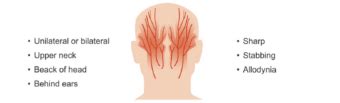 Cranial neuralgias • LITFL • Neurology library