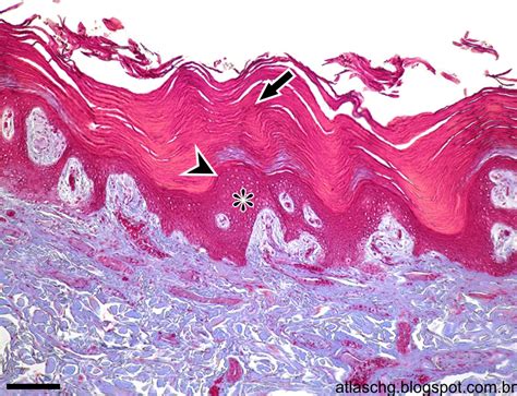 Atlas De Citologia E Histologia Tecido Epitelial De Revestimento