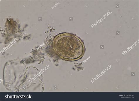 Ascaris Lumbricoides Egg Stool Examlarge Roundworm Stock Photo Edit