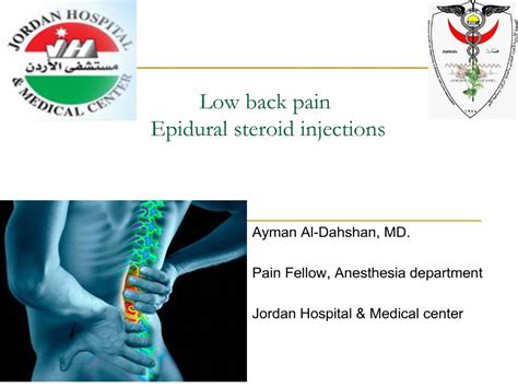 PPT - Low back pain Epidural steroid injections PowerPoint Presentation