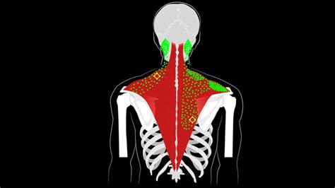 Trapezius Trigger Points Why My Traps Are Tight Muscle Pain