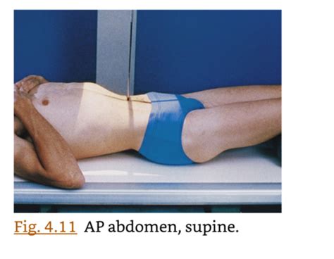 Abdomen Projections Flashcards Quizlet