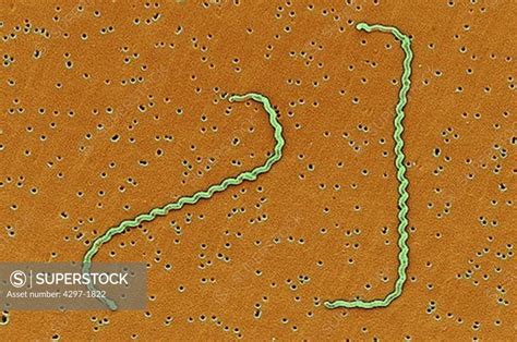 Scanning Electron Micrograph Of Leptospira Interrogans Strain Rga