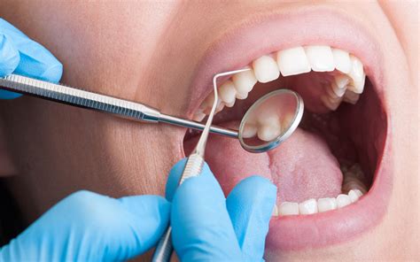 Duele Una Endodoncia Cl Nica Dental San Blas Madrid