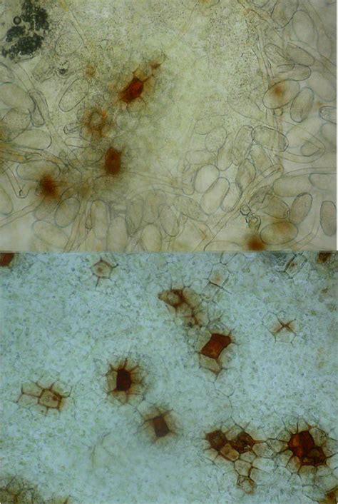 Uncinula Necator Mycologie Microscopique Mikroscopia