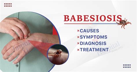 Babesiosis Causes Symptoms Diagnosis And Treatment Jaipur Hospital