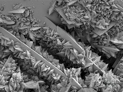 Kidney Stone Surface Photograph By Thomas Deerinck Ncmirscience Photo