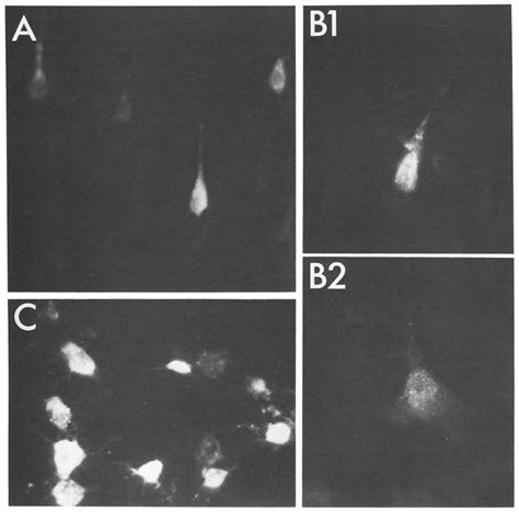 Photomicrographs Of Neurons Labeled With Fluorescent Dyes A Shows Download Scientific Diagram