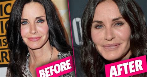 Frozen Face! Courteney Cox Had EXTREME Plastic Surgery On 'Lips, Eyes & Cheeks,' Top Docs Reveal ...